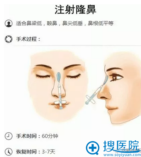 隆鼻的方法有哪些?结合优缺点与价格衡量我适合哪种隆鼻方式