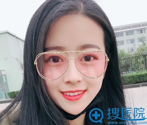 眼部整形医生回答爱美者提出的:近视眼能做双眼皮手术吗?
