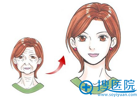 做一次电波拉皮多少钱?面部电波拉皮价格表及案例效果展示