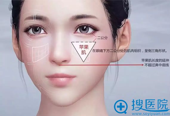 除了自体脂肪丰苹果肌还有哪些方法填充苹果肌,价格是多少钱?