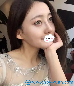 驻马店美兰德整形美容医院鼻综合效果怎么样 驻马店美兰德整形美容医院鼻综合效果怎么样