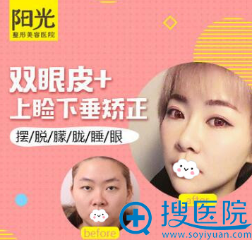 <!--<i data=20240710 data-id=12045></i>-->整形美容医院双眼皮案例对比 <!--<i data=20240710 data-id=12045></i>-->整形美容医院双眼皮案例对比