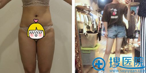 ������������Ƶ��֬�ݴ��Ȱ���
