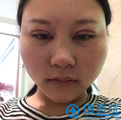 �ڹ�����������˫��Ƥ������