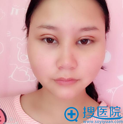 ȫ��˫��Ƥ����5��ָ�Ч��ͼ