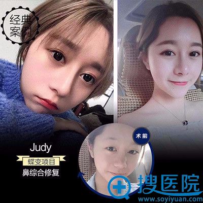 ���ݺ�ϿѦ�ˉ����ı��ۺ�¡�ǰ���