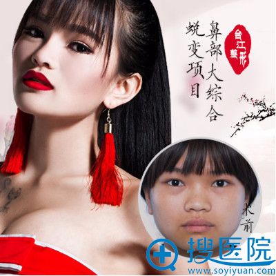 ����̨��ҽԺ�°������ı��ۺ�¡�ǰ���
