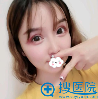 成都<!--<i data=20240710 data-id=16572></i>-->眼整形与修复医学研究院眼部修复效果图 成都<!--<i data=20240710 data-id=16572></i>-->眼整形与修复医学研究院眼部修复效果图