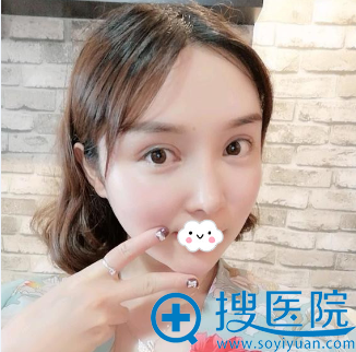 成都莱尹<!--<i data=20240710 data-id=16572></i>-->双眼皮失败修复真人案例 成都莱尹<!--<i data=20240710 data-id=16572></i>-->双眼皮失败修复真人案例