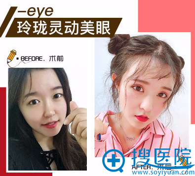 ���찮˼��¬��������˫��Ƥ����