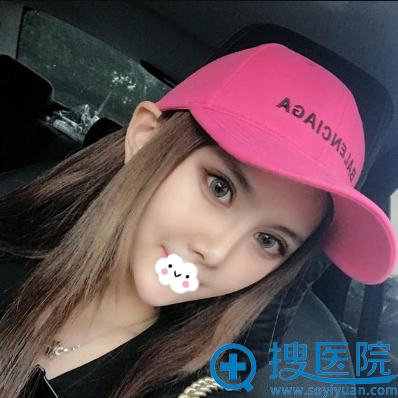 杨权明双眼皮术后化妆效果 杨权明双眼皮术后化妆效果
