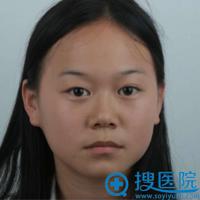 在<!--<i data=20240710 data-id=13582></i>-->整形医院做双眼皮手术前 在<!--<i data=20240710 data-id=13582></i>-->整形医院做双眼皮手术前