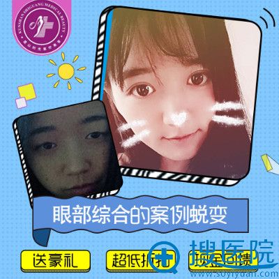 <!--<i data=20240710 data-id=13582></i>-->����ҽԺ���ຣ����˫��Ƥ����