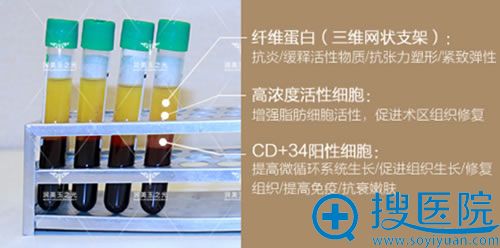 ������֮��CGF����ϸ��
