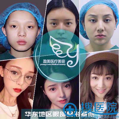 上海盈美整形医院杨璐做的双眼皮修复案例 上海盈美整形医院杨璐做的双眼皮修复案例