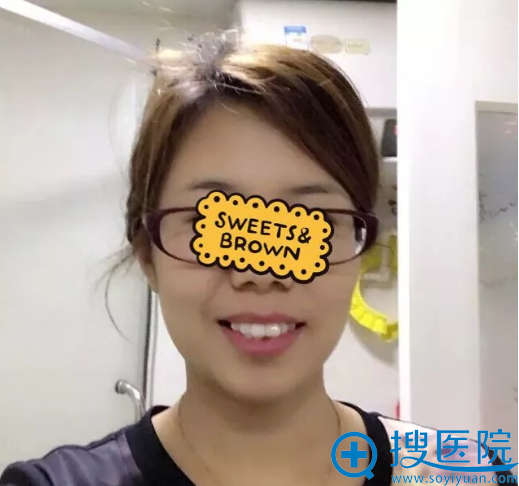 矫正牙齿要多少钱?贵阳华美隐形牙齿矫正价格16900元起附案例