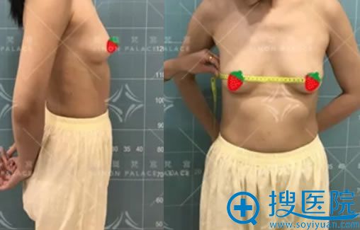 ��ǰ���������ȳ�֬������֬����ֲ¡������ʧ�ܸ���ô��?