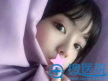 全切双眼皮一个月的恢复效果 全切双眼皮一个月的恢复效果