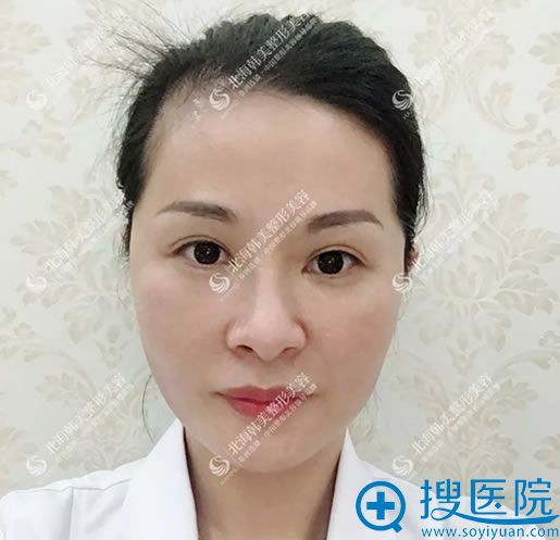 北京韩美线雕案例效果图 北京韩美线雕案例效果图