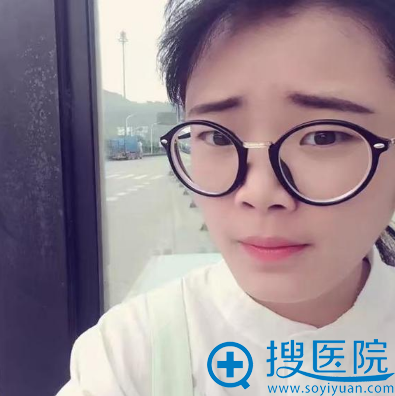 在福州海峡整形医院做双眼皮手术前 在福州海峡整形医院做双眼皮手术前