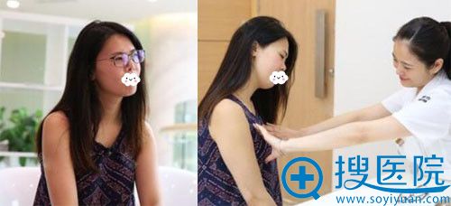 看过华美和当代假体隆胸案例价格后让重庆联合丽格王岩胸整形