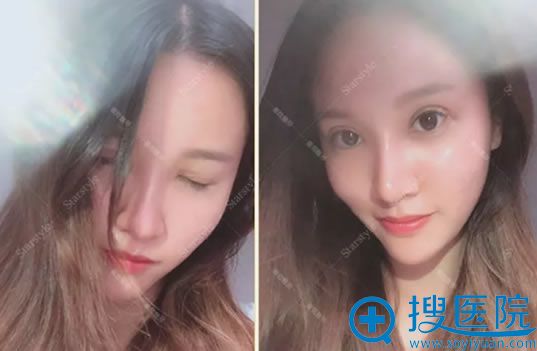 ����˫��Ƥ�Ϳ��۽�10��̺���