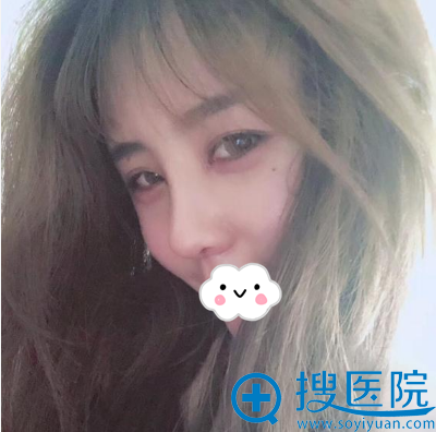 <!--<i data=20240710 data-id=11494></i>-->解学江鼻头缩小手术 <!--<i data=20240710 data-id=11494></i>-->解学江鼻头缩小手术