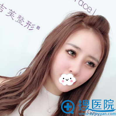 <!--<i data=20240710 data-id=11494></i>-->解学江假体隆鼻术后效果 <!--<i data=20240710 data-id=11494></i>-->解学江假体隆鼻术后效果