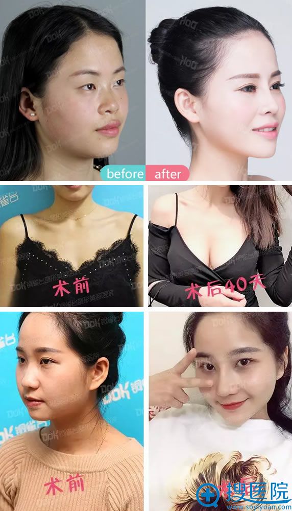 成都铜雀台真人案例 成都铜雀台真人案例