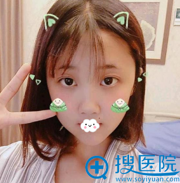重庆爱思特下颌角整形效果怎么样? 重庆爱思特下颌角整形效果怎么样?