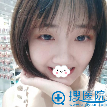 下颌角整形哪家好?重庆爱思特高伟磨骨案例效果图 下颌角整形哪家好?重庆爱思特高伟磨骨案例效果图