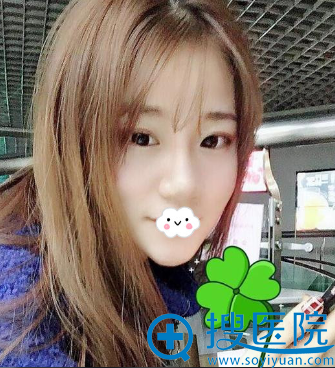 宁夏华美<!--<i data=20240710 data-id=16566></i>-->斐鼻综合隆鼻整形术后恢复图 宁夏华美<!--<i data=20240710 data-id=16566></i>-->斐鼻综合隆鼻整形术后恢复图