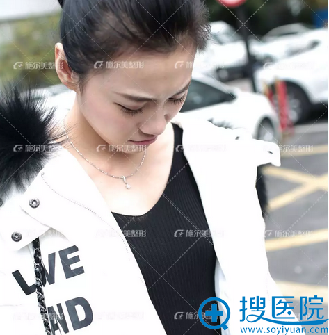 看了南京施尔美跟华美的案例价格后我找李彤彤做了自体脂肪隆胸
