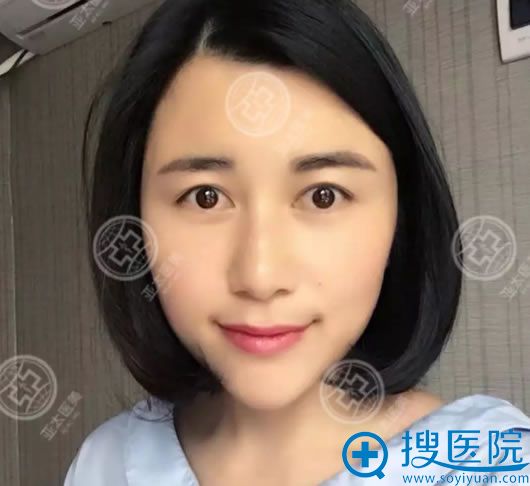 在<!--<i data=20240710 data-id=12286></i>-->做双眼皮之前 在<!--<i data=20240710 data-id=12286></i>-->做双眼皮之前