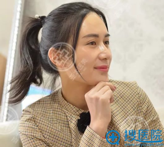 <!--<i data=20240710 data-id=12286></i>-->双眼皮案例7天效果 <!--<i data=20240710 data-id=12286></i>-->双眼皮案例7天效果
