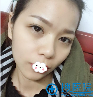 �Ϲ�˵���ڳ�ɳ������־�մ���������֬�����ȫ��Ч���ܺã�
