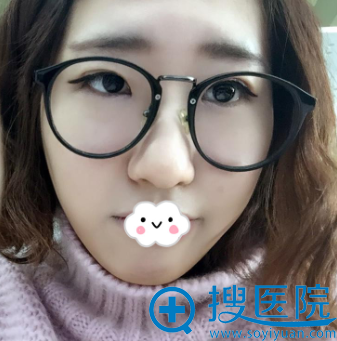 <!--<i data=20240710 data-id=11225></i>-->医疗美容整形医院割双眼皮效果怎么样? <!--<i data=20240710 data-id=11225></i>-->医疗美容整形医院割双眼皮效果怎么样?