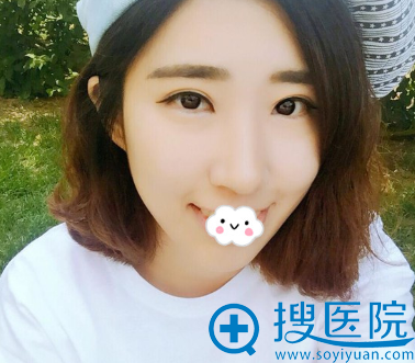 <!--<i data=20240710 data-id=11225></i>-->双眼皮恢复案例效果图 <!--<i data=20240710 data-id=11225></i>-->双眼皮恢复案例效果图