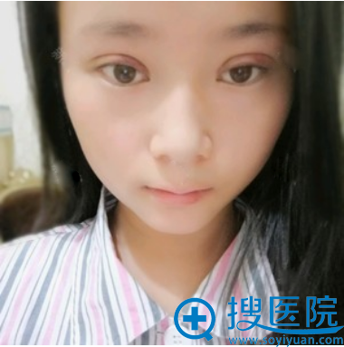 ���Ļ�������ҽ������˫��Ƥ��������
