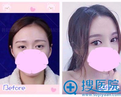 �ൺ��������骿����������˫��Ƥ��������֤