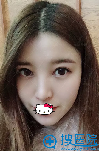 减龄又变美的鼻子,喜欢吗? 减龄又变美的鼻子,喜欢吗?