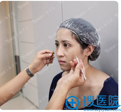 在<!--<i data=20240710 data-id=12757></i>-->唐毅双眼皮术前设计 在<!--<i data=20240710 data-id=12757></i>-->唐毅双眼皮术前设计