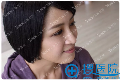 <!--<i data=20240710 data-id=12757></i>-->美杜莎美眼双眼皮效果图 <!--<i data=20240710 data-id=12757></i>-->美杜莎美眼双眼皮效果图
