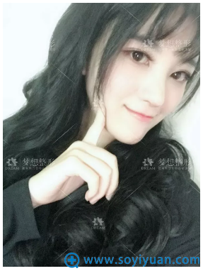 昆明梦想胡凯做的隆鼻案例 昆明梦想胡凯做的隆鼻案例
