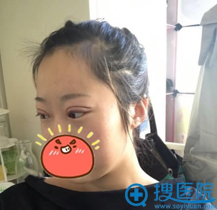 ������˫��Ƥ����Ƭ