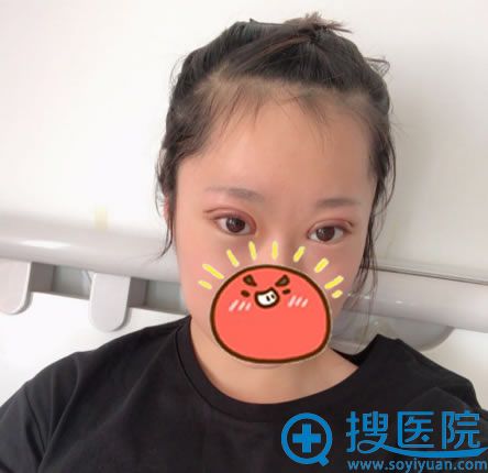 ���庫������ҽԺ��˫��Ƥ3��Ч��