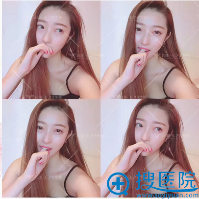 ����֬���沿�������һ�����������