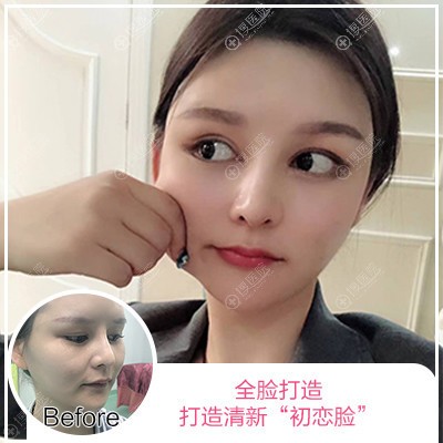 <!--<i data=20240710 data-id=12088></i>-->����ҽԺҽ����������֬���沿��䰸��
