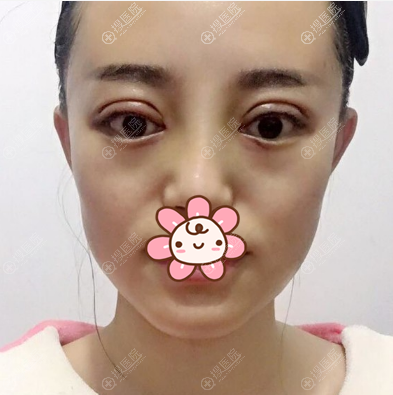 �½��������������п�˫��Ƥ