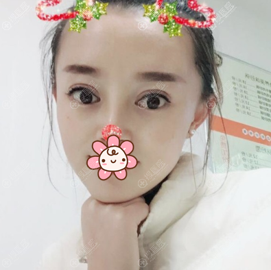 ����Ժ���п�˫��Ƥ����20��